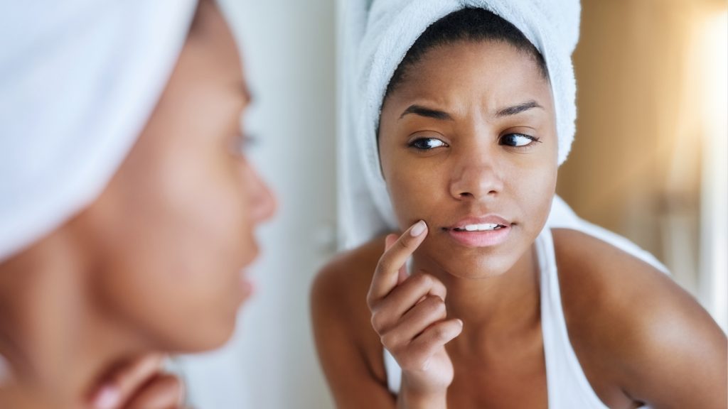 Skin breakouts due to sleep deprivation